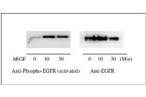 Image no. 3 for Epidermal Growth Factor Receptor (EGFR) ELISA Kit (ABIN1981821)