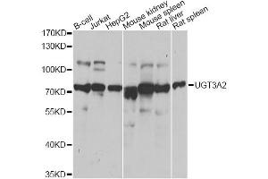 Image no. 1 for anti-UDP Glycosyltransferase 3 Family, Polypeptide A2 (UGT3A2) antibody (ABIN6571236)