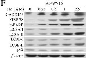 Image no. 15 for anti-Sequestosome 1 (SQSTM1) (Internal Region) antibody (ABIN2854836)