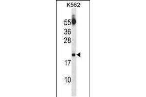 Image no. 1 for anti-Sin3A-Associated Protein, 18kDa (SAP18) (AA 58-86) antibody (ABIN5537590)