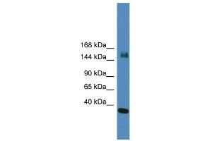 Image no. 1 for anti-Lysine (K)-Specific Demethylase 6A (KDM6A) (N-Term) antibody (ABIN2781141)
