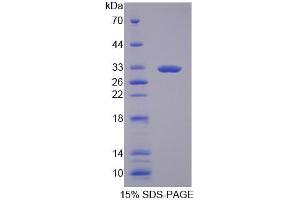 Image no. 1 for Guanylate Binding Protein 3 (GBP3) protein (ABIN6119481)
