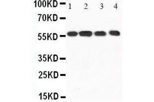 CAMKK1 Antikörper  (N-Term)