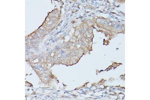 CEACAM1 antibody  (AA 300-430)