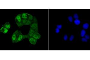 Image no. 5 for anti-cAMP Responsive Element Binding Protein 1 (CREB1) antibody (ABIN4903372)