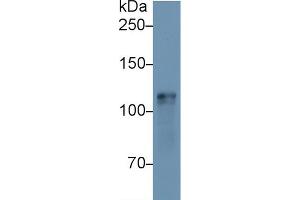 Image no. 2 for anti-Hexokinase 1 (HK1) (AA 137-270) antibody (ABIN1173547)