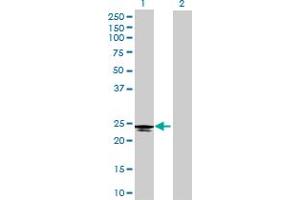 Western Blot analysis of C6orf25 expression in transfected 293T cell line by C6orf25 MaxPab polyclonal antibody.