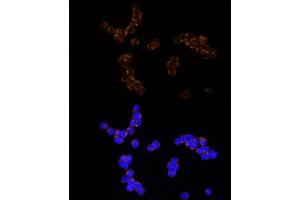 NUDT19 antibody