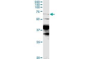Image no. 3 for anti-Cytoplasmic Polyadenylation Element Binding Protein 1 (CPEB1) (AA 1-486) antibody (ABIN949598)