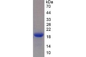 Image no. 4 for Brain Natriuretic Peptide (BNP) ELISA Kit (ABIN6574089)
