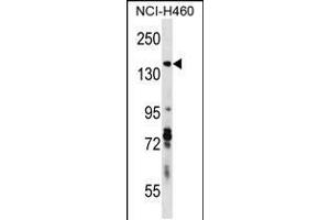 Image no. 1 for anti-Diaphanous Homolog 3 (Drosophila) (DIAPH3) (AA 1061-1090), (C-Term) antibody (ABIN5539348)