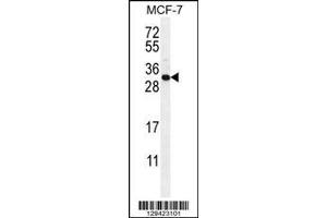 Image no. 1 for anti-Complement Component 1, Q Subcomponent-Like 4 (C1QL4) (AA 1-30), (N-Term) antibody (ABIN655459)