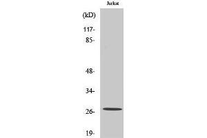 Image no. 1 for anti-Potassium Large Conductance Calcium-Activated Channel, Subfamily M, beta Member 2 (KCNMB2) (Internal Region) antibody (ABIN3180722)