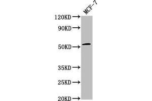 Western Blot Positive WB detected in: MCF-7 whole cell lysate All lanes: PPM1J antibody at 1:2000 Secondary Goat polyclonal to rabbit IgG at 1/50000 dilution Predicted band size: 55, 34 kDa Observed band size: 55 kDa