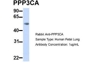 Image no. 3 for anti-Protein Phosphatase 3, Catalytic Subunit, alpha Isoform (PPP3CA) (Middle Region) antibody (ABIN2784524)