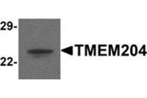 Image no. 1 for anti-Transmembrane Protein 204 (TMEM204) (C-Term) antibody (ABIN783526)