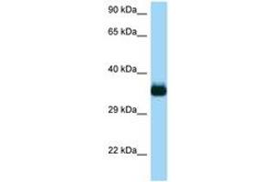 Image no. 1 for anti-CDC42 Effector Protein (Rho GTPase Binding) 4 (CDC42EP4) (AA 150-199) antibody (ABIN6748281)