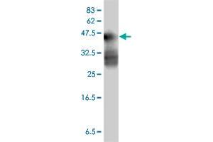 Image no. 1 for anti-Melanoma Antigen Family A, 12 (MAGEA12) (AA 70-168) antibody (ABIN561738)
