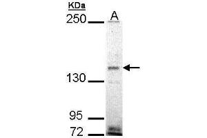 Image no. 2 for anti-EH Domain Binding Protein 1 (EHBP1) (Internal Region) antibody (ABIN2856735)
