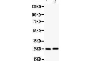 Image no. 2 for anti-Claudin 2 (CLDN2) (AA 38-230) antibody (ABIN3042751)