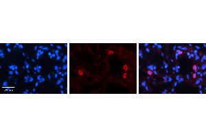 Image no. 3 for anti-Nuclear Factor of Activated T-Cells, Cytoplasmic, Calcineurin-Dependent 4 (NFATC4) (N-Term) antibody (ABIN2780606)