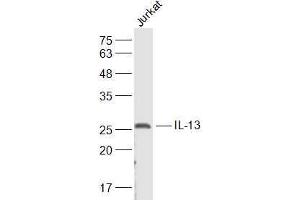Image no. 5 for anti-Interleukin 13 (IL13) (AA 45-56) antibody (ABIN670116)