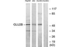 Image no. 1 for anti-Protein Kinase C Substrate 80K-H (PRKCSH) (AA 81-130) antibody (ABIN1533618)