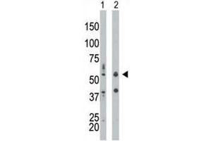 Image no. 3 for anti-Eukaryotic Translation Initiation Factor 2-alpha Kinase 2 (EIF2AK2) (AA 11-42) antibody (ABIN3030884)