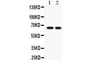 Image no. 1 for anti-Transforming Growth Factor, beta Receptor II (70/80kDa) (TGFBR2) (AA 330-346), (Middle Region) antibody (ABIN3044092)