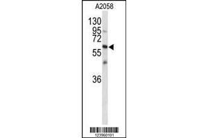 Image no. 1 for anti-Contactin 1 (CNTN1) (AA 635-662) antibody (ABIN653443)