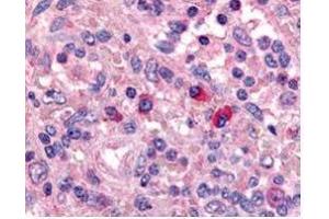 Affinity Purified anti-Artemis antibody was used at a 1:1000 dilution to detect Artemis by immunohistochemistry in human spleen.