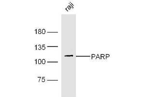 Image no. 5 for anti-Poly (ADP-Ribose) Polymerase 1 (PARP1) (AA 201-300) antibody (ABIN677903)