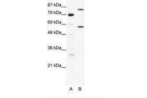 Image no. 1 for anti-Myoneurin (MYNN) (AA 371-420) antibody (ABIN202811)