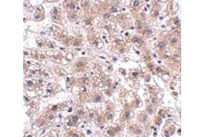Image no. 3 for anti-Actin Filament Associated Protein 1-Like 2 (AFAP1L2) (C-Term) antibody (ABIN6656967)