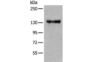 Western blot analysis of Mouse brain tissue lysate using PTPRA Polyclonal Antibody at dilution of 1:400
