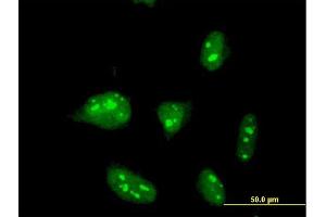 Immunofluorescence of monoclonal antibody to ZNF611 on HeLa cell.