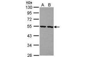 Image no. 1 for anti-Peptidase Inhibitor 16 (PI16) (AA 1-152) antibody (ABIN1500193)