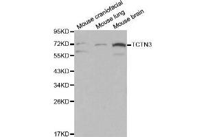 Image no. 1 for anti-Tectonic Family Member 3 (TCTN3) antibody (ABIN1513593)