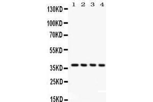 Image no. 3 for anti-COP9 Constitutive Photomorphogenic Homolog Subunit 5 (Arabidopsis) (COPS5) (AA 8-334) antibody (ABIN3042754)