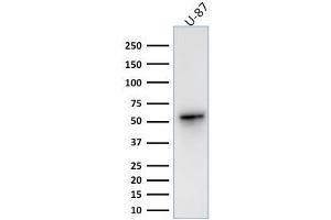 Western Blotting (WB) image for anti-Vimentin (VIM) antibody (ABIN6940885)