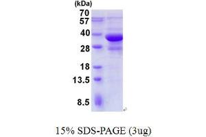 Image no. 1 for SH3-Domain GRB2-Like Endophilin B1 (SH3GLB1) protein (His tag) (ABIN1098454)