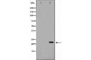 Image no. 2 for anti-Nucleoside diphosphate kinase B (NME2) (Internal Region) antibody (ABIN6263661)