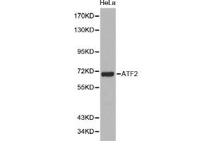 ATF2 抗体  (AA 1-190)