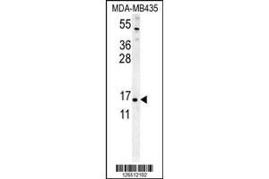 Western Blotting (WB) image for anti-Enhancer of Yellow 2 Homolog (ENY2) antibody (ABIN2158709)