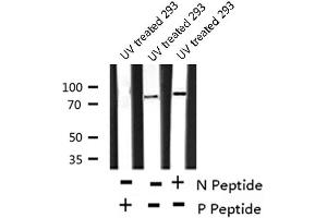 Image no. 5 for anti-Protein Kinase C, delta (PKCd) (pSer664) antibody (ABIN6271530)