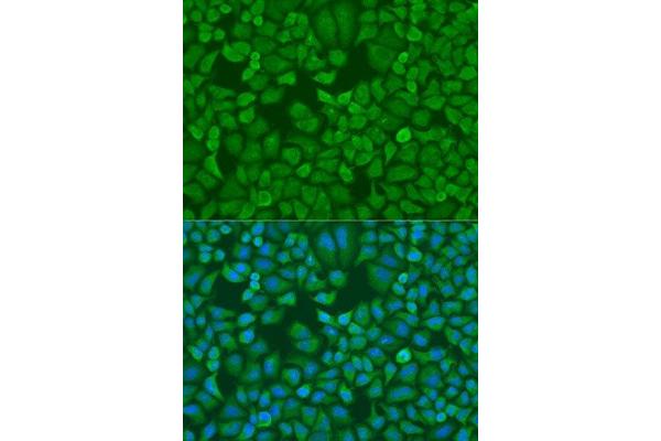 IGF2BP1 antibody  (C-Term)