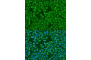 Image no. 4 for anti-Insulin-Like Growth Factor 2 mRNA Binding Protein 1 (IGF2BP1) antibody (ABIN3022057)