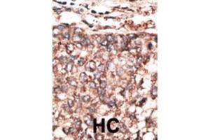 Image no. 1 for anti-Platelet Derived Growth Factor D (PDGFD) (AA 313-341) antibody (ABIN390196)