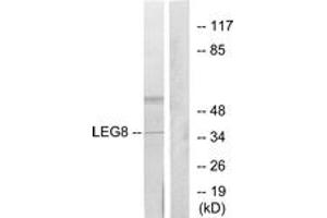Image no. 1 for anti-Lectin, Galactoside-Binding, Soluble, 8 (LGALS8) (AA 61-110) antibody (ABIN1534464)