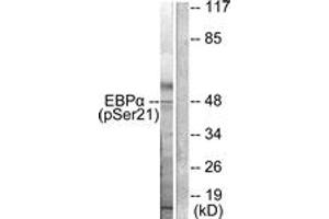 Western blot analysis of extracts from HepG2 cells treated with EGF 200ng/ml 5', using C/EBP-alpha (Phospho-Ser21) Antibody.